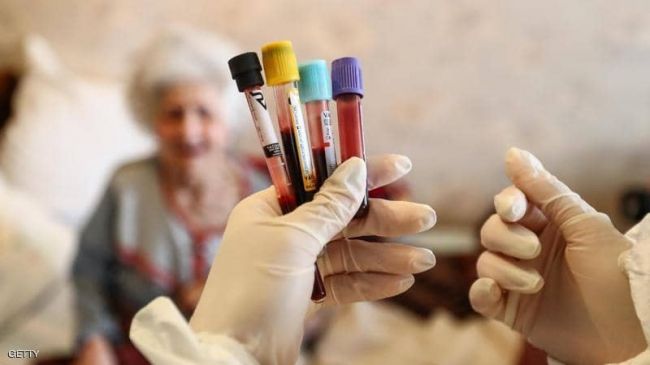 مع مخاوف لقاح أسترازينيكا.. هذه علامات الإصابة بجلطات الدم