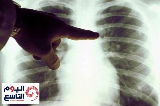 "مشهور في عدن" موجود في كل بيت.. طبيب سعودي يحذر من القاتل الصامت الذي يجهله الكثير من الناس