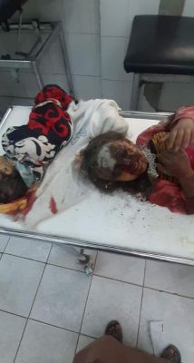استشهاد واصابة 35 مدنيا بينهم نساء وأطفال ورضع.. بسبب الصواريخ البالستية الحوثية