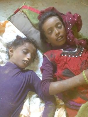 أمطار لحج تقتل فتاتين في قرية الزيادي بتبن