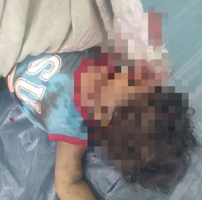 مقتل طفلة في هجوم مسيرات حوثية في حيفان