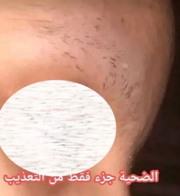 تعز: محامي يمني يمارس السادية على زوجته في الحوبان